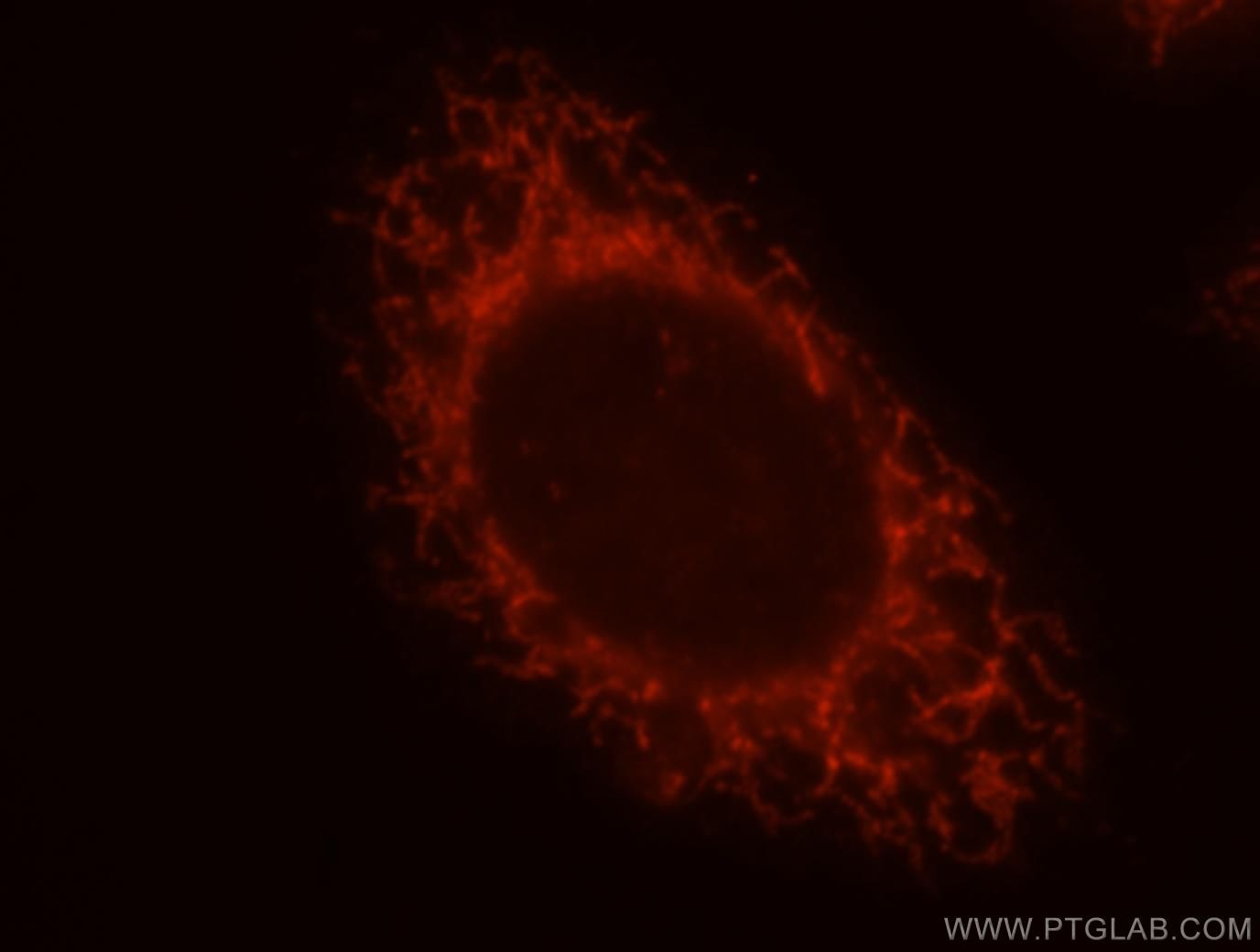 MRPS27 Immunofluorescence IF 17280-1-AP MRPS27 Antibody FLJ21764; FLJ23348; KIAA0264; MRP-S27; S27mt