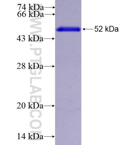 MSRA fusion protein ag6053 SDS-PAGE