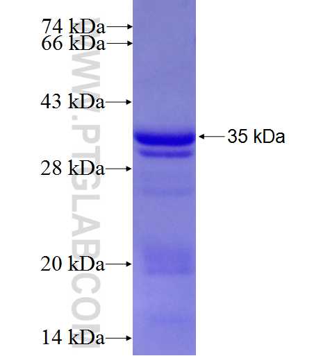 MTG1 fusion protein ag5397 SDS-PAGE