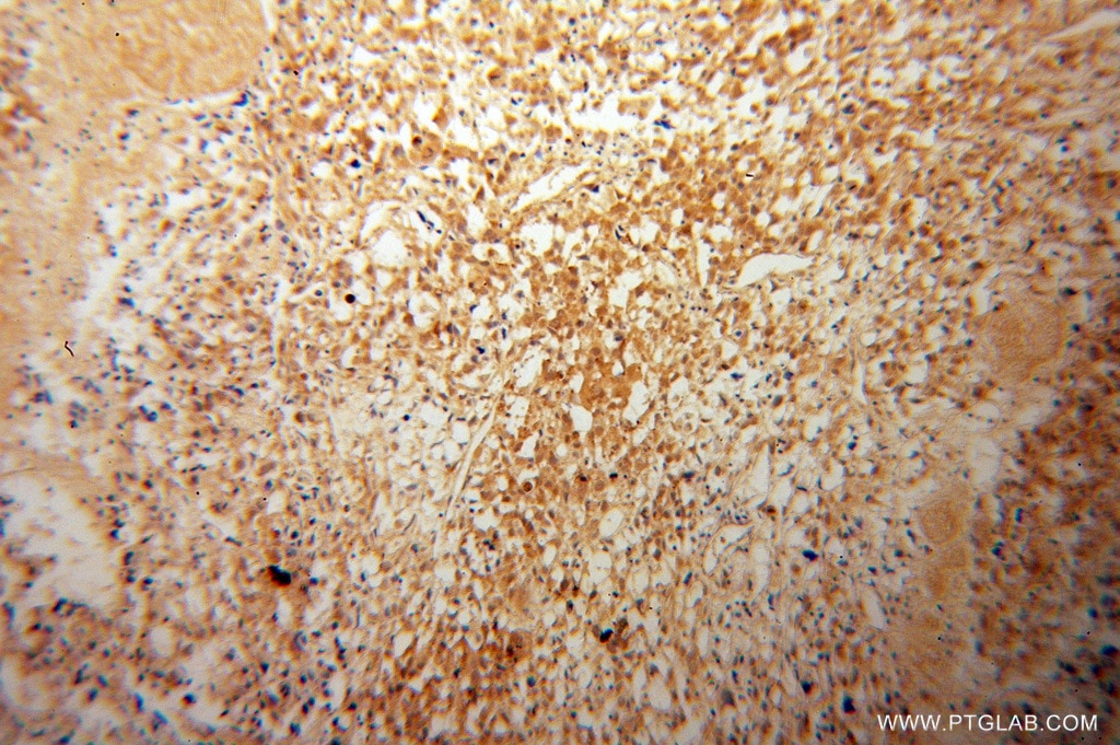 MTM1 IHC Immunohistochemical 13924-1-AP MTM1 Antibody CNM; MTMX; XLMTM