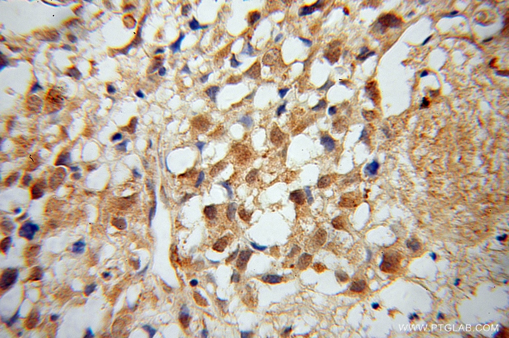 MTM1 IHC Immunohistochemical 13924-1-AP MTM1 Antibody CNM; MTMX; XLMTM