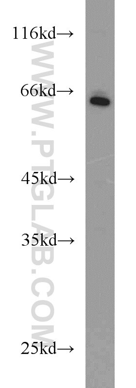 MTM1 western blot WB 13924-1-AP MTM1 Antibody CNM; MTMX; XLMTM