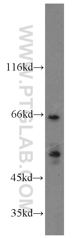 K-562 cells were subjected to SDS PAGE followed by western blot with 15237-1-AP(MUTYH Antibody) at dilution of 1:800 MUTYH western blot WB 15237-1-AP MUTYH Antibody MGC4416; MYH