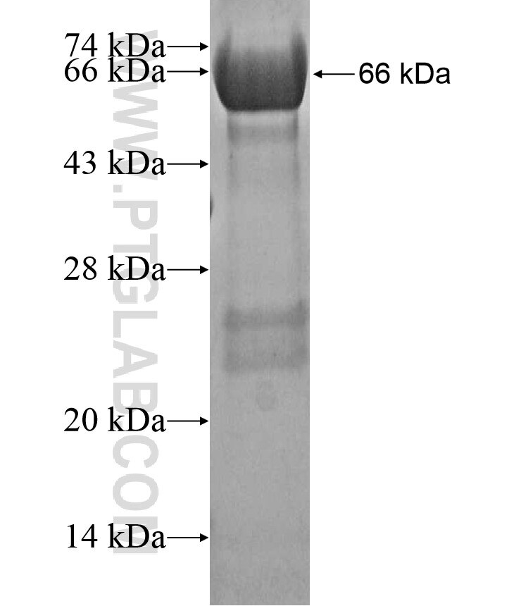 MYOM1 fusion protein ag17263 SDS-PAGE