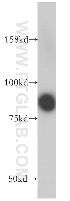 MYST2 western blot WB 13751-1-AP MYST2 Antibody HBO1; HBOA; KAT7