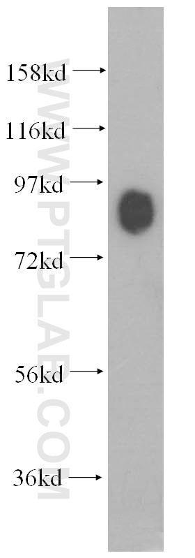 mouse brain tissue were subjected to SDS PAGE followed by western blot with 10004-2-Ig(Marcks Antibody) at dilution of 1:3000 Marcks western blot WB 10004-2-Ig Marcks Antibody Macs; PKCSL