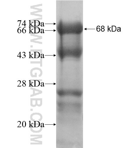 NAB1 fusion protein ag13407 SDS-PAGE