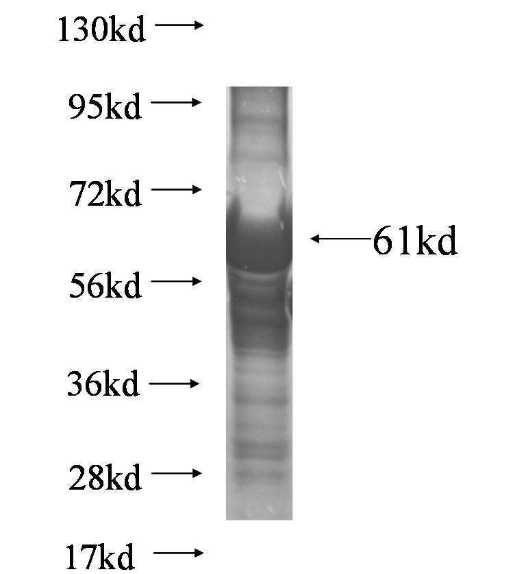 NAB2 fusion protein ag6221 SDS-PAGE