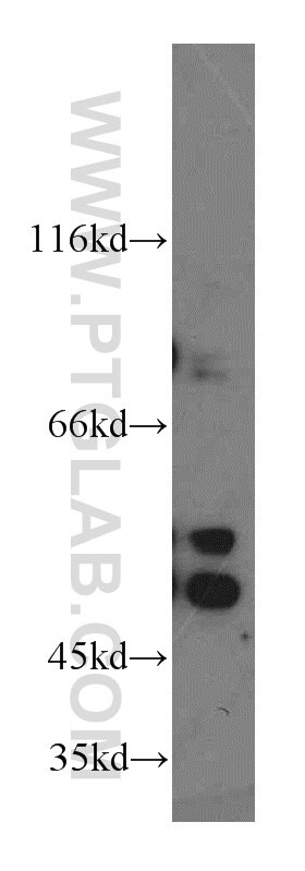 HEK-293 cells were subjected to SDS PAGE followed by western blot with 13549-1-AP(NAPRT1 Antibody) at dilution of 1:1200 NAPRT1 western blot WB 13549-1-AP NAPRT1 Antibody PP3856