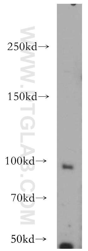 COLO 320 cells were subjected to SDS PAGE followed by western blot with 11875-1-AP(NAV2 Antibody) at dilution of 1:600 NAV2 western blot WB 11875-1-AP NAV2 Antibody FLJ10633; FLJ11030; FLJ23707; FLJ77876; HELAD1; KIAA1419; POMFIL2; RAINB1; STEERIN2; UNC53H2