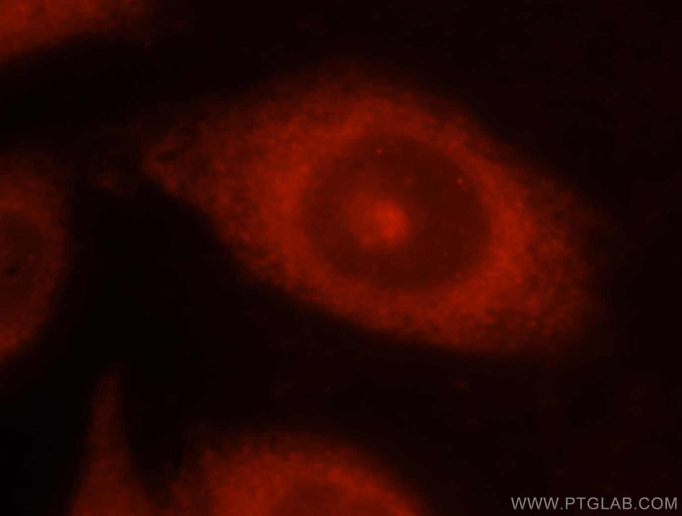 NCK1 Immunofluorescence IF 15247-1-AP NCK1 Antibody MGC12668; NCK; NCKalpha