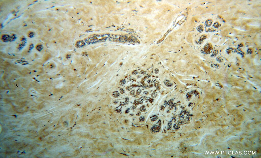 NCK1 IHC Immunohistochemical 15247-1-AP NCK1 Antibody MGC12668; NCK; NCKalpha