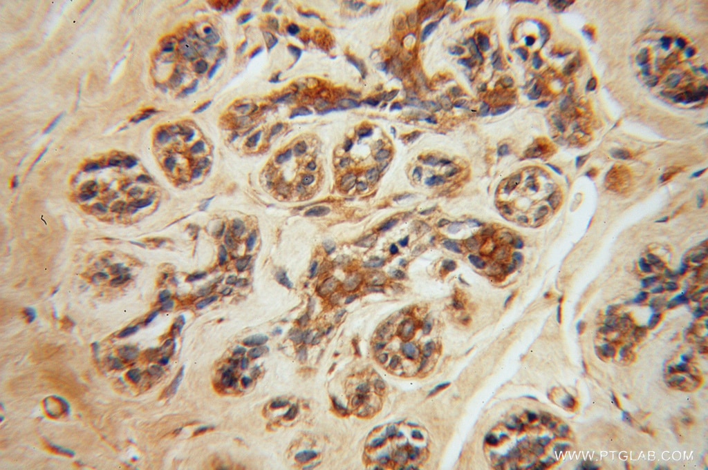 NCK1 IHC Immunohistochemical 15247-1-AP NCK1 Antibody MGC12668; NCK; NCKalpha