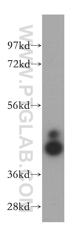 NCK1 western blot WB 15247-1-AP NCK1 Antibody MGC12668; NCK; NCKalpha