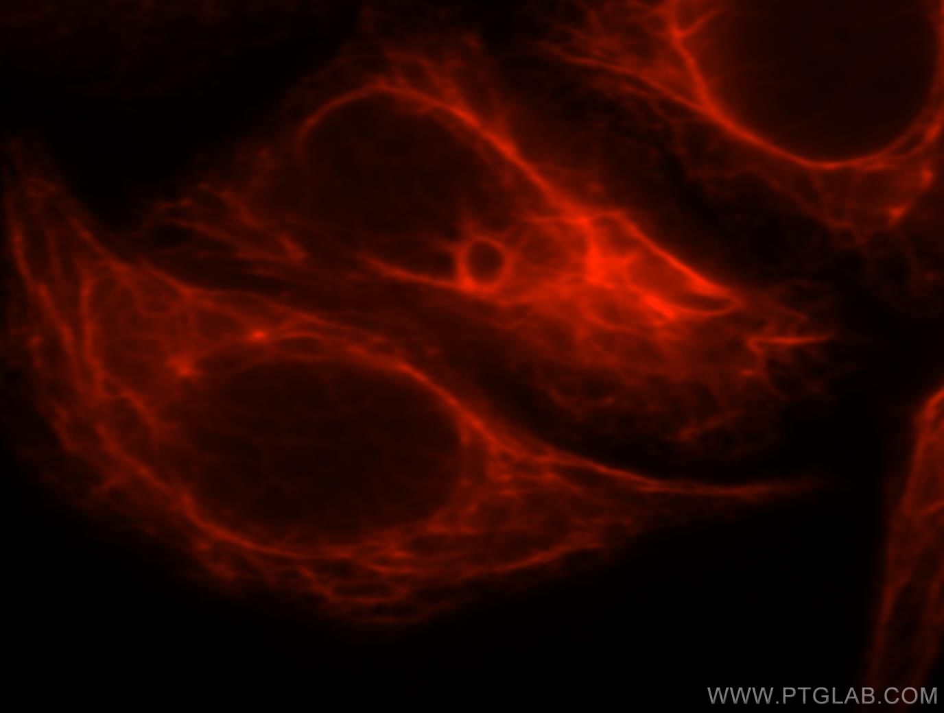 NDUFA4L2 Immunofluorescence IF 16480-1-AP NDUFA4L2 Antibody NDUFA4L2;FLJ26118;NUOMS ;