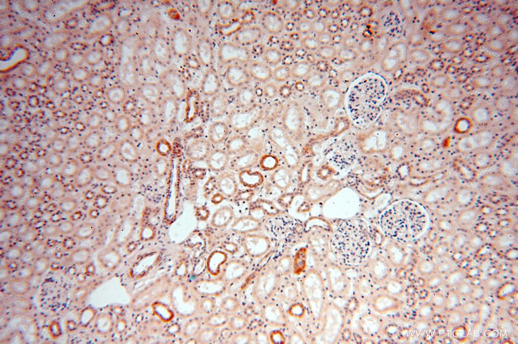 NDUFA4L2 IHC Immunohistochemical 16480-1-AP NDUFA4L2 Antibody NDUFA4L2;FLJ26118;NUOMS ;