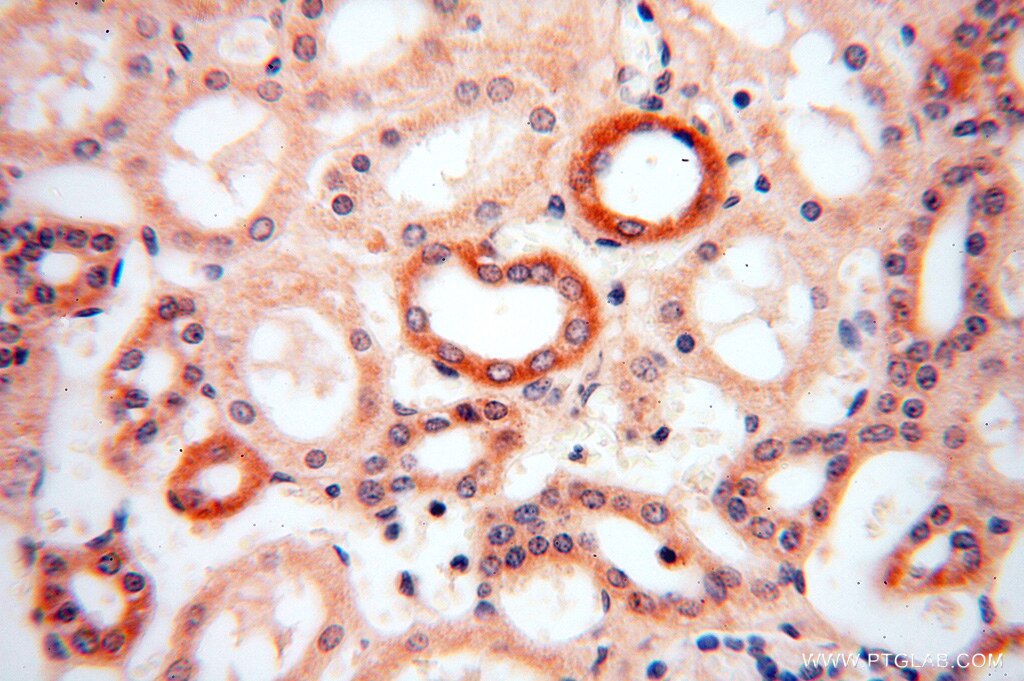 NDUFA4L2 IHC Immunohistochemical 16480-1-AP NDUFA4L2 Antibody NDUFA4L2;FLJ26118;NUOMS ;