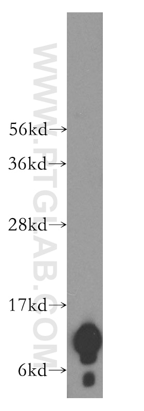 NDUFA4L2 western blot WB 16480-1-AP NDUFA4L2 Antibody NDUFA4L2;FLJ26118;NUOMS ;