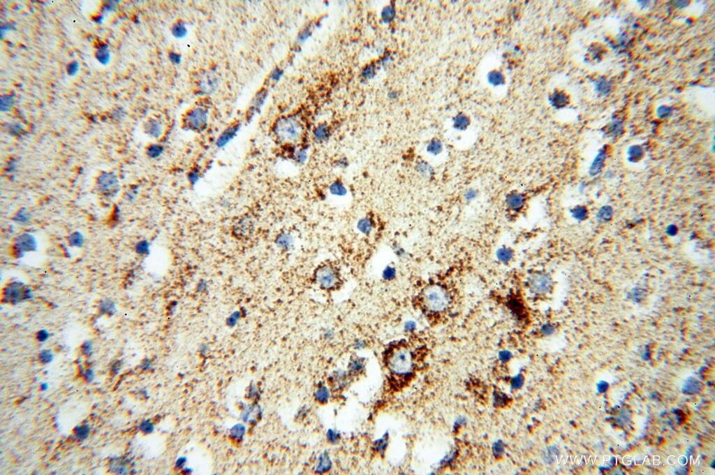 NDUFB7 IHC Immunohistochemical 14912-1-AP NDUFB7 Antibody B18; CI-B18; MGC2480