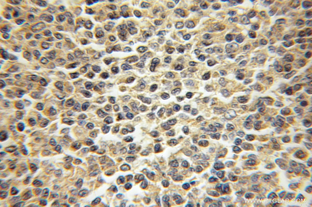NEK9 IHC Immunohistochemical 11192-1-AP NEK9 Antibody DKFZp434D0935; MGC138306; MGC16714; NERCC; NERCC1; Nek8