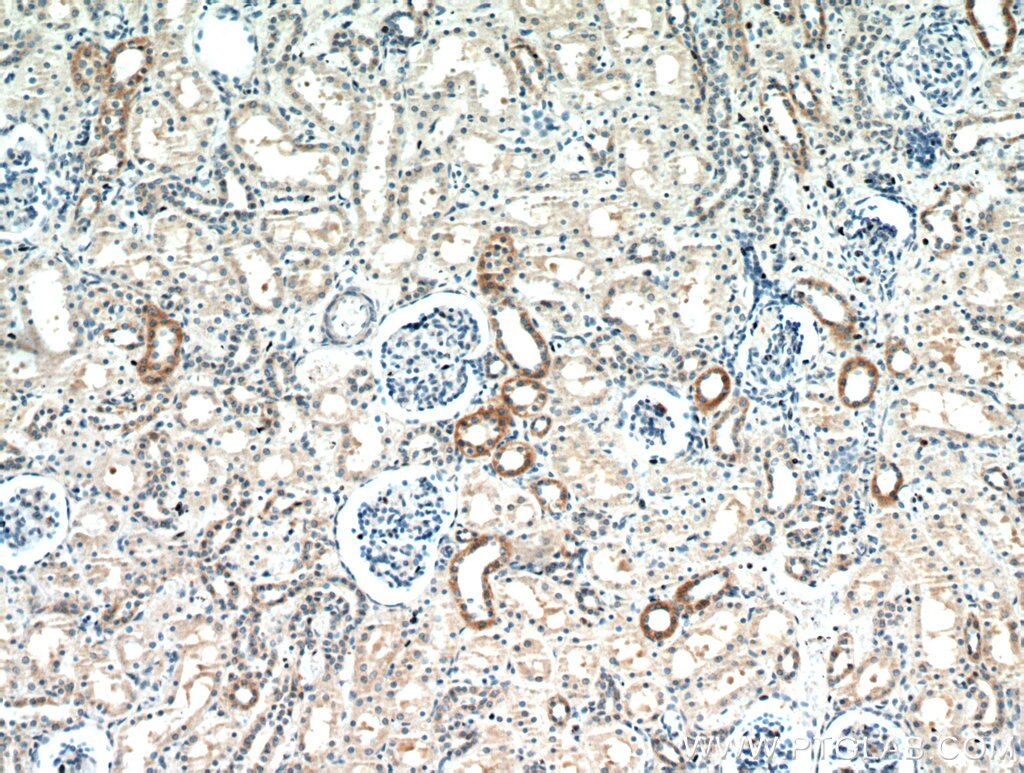 NELL1 IHC Immunohistochemical 21783-1-AP NELL1 Antibody FLJ45906; IDH3GL; NRP1