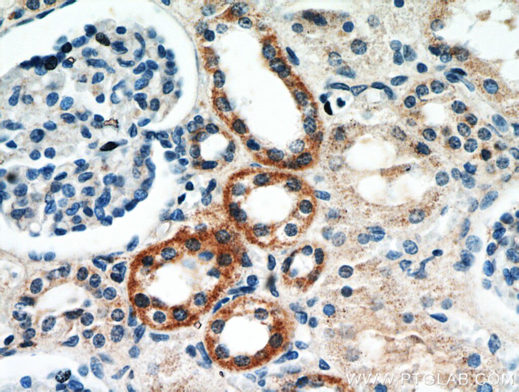 NELL1 IHC Immunohistochemical 21783-1-AP NELL1 Antibody FLJ45906; IDH3GL; NRP1