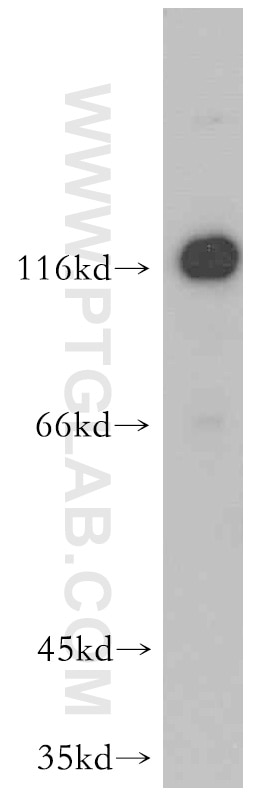 NELL1 western blot WB 21783-1-AP NELL1 Antibody FLJ45906; IDH3GL; NRP1