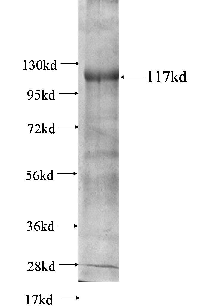 NELL2 fusion protein ag0703 SDS-PAGE