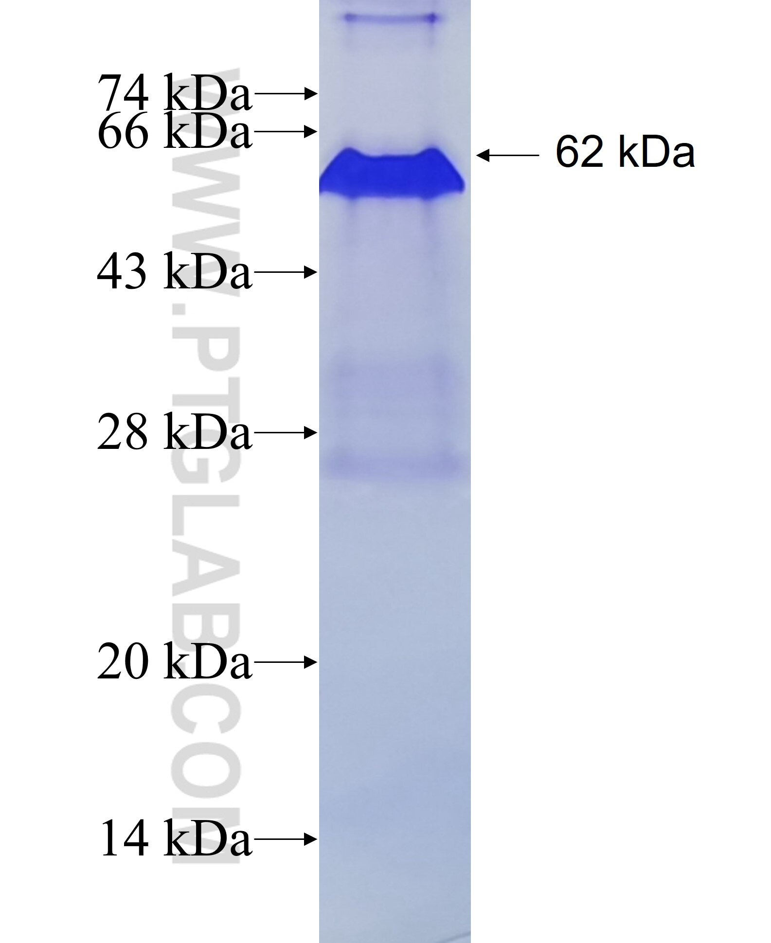 NELL2 fusion protein ag1793 SDS-PAGE