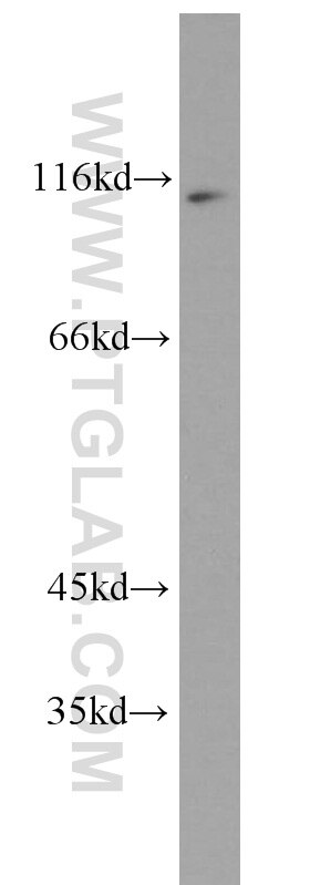 HeLa cells were subjected to SDS PAGE followed by western blot with 10409-2-AP(NFKB2 Antibody) at dilution of 1:500 NFKB2 western blot WB 10409-2-AP NFKB2 Antibody LYT-10; LYT10