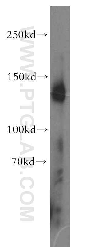 human placenta tissue were subjected to SDS PAGE followed by western blot with 13766-1-AP(NID1 Antibody) at dilution of 1:600 NID1 western blot WB 13766-1-AP NID1 Antibody NID