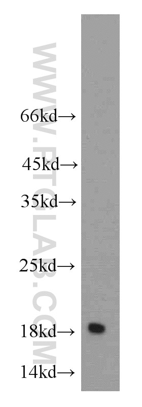 NME3 western blot WB 15136-1-AP NME3 Antibody DR-nm23; KIAA0516; NDPK-C; NDPKC; NM23-H3; c371H6.2