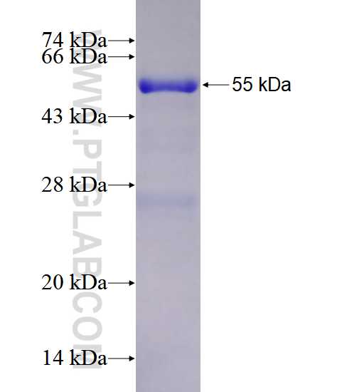 NMNAT1 fusion protein ag1944 SDS-PAGE