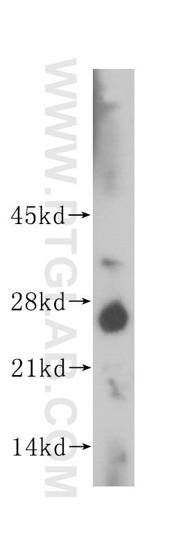 NOG western blot WB 14772-1-AP NOG Antibody SYM1; SYNS1