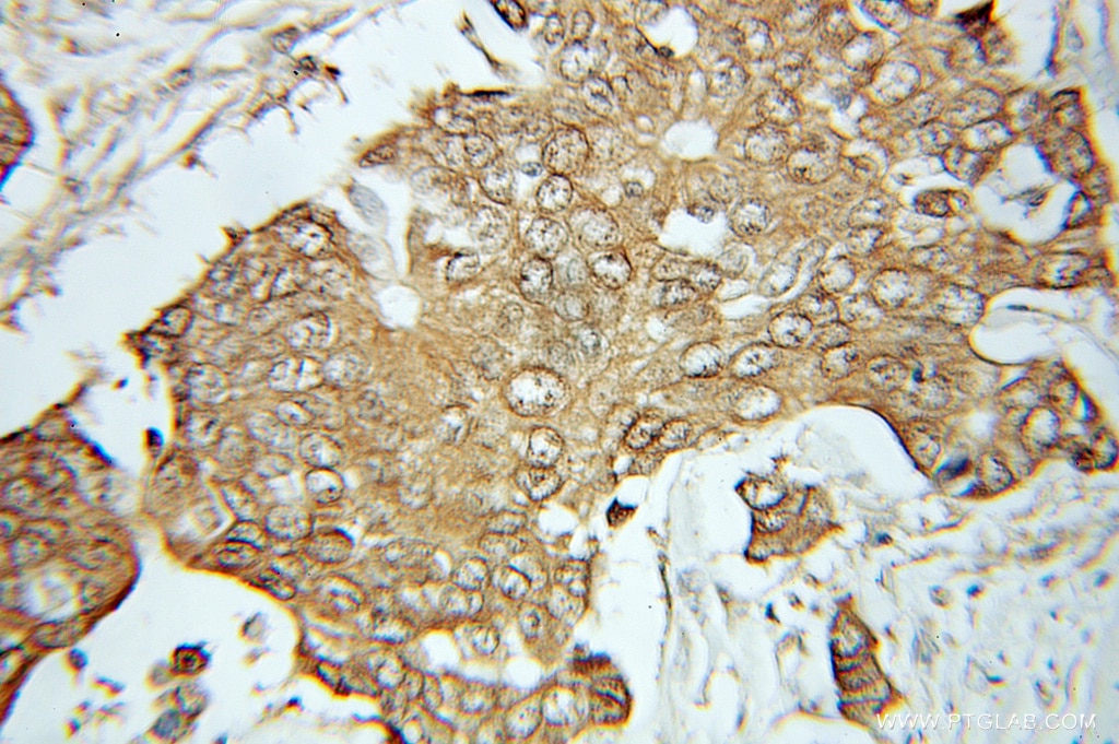 NOL3 IHC Immunohistochemical 10846-2-AP NOL3 Antibody ARC; CARD2; MYC; MYP; NOP; NOP30