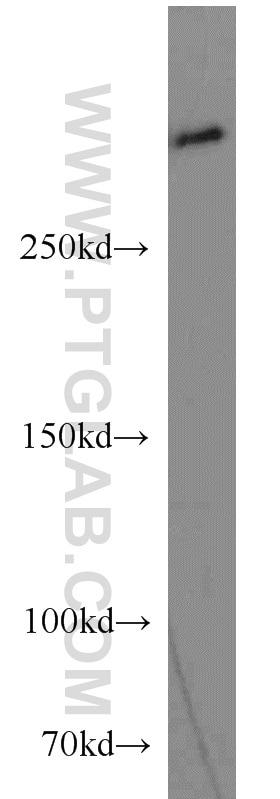 NOTCH1 western blot WB 20687-1-AP NOTCH1 Antibody TAN1; hN1