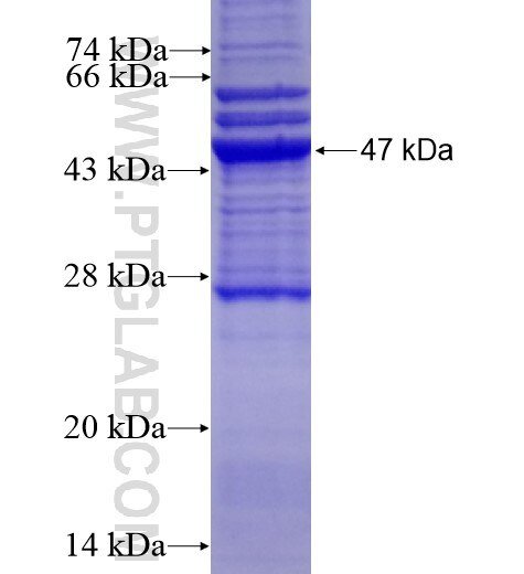 NPHS2 fusion protein ag14213 SDS-PAGE