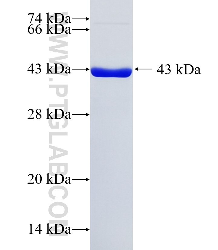 NR2C2AP fusion protein ag5133 SDS-PAGE