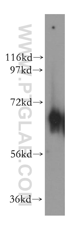 human placenta tissue were subjected to SDS PAGE followed by western blot with 15223-1-AP(NT5C2 Antibody) at dilution of 1:1000 NT5C2 western blot WB 15223-1-AP NT5C2 Antibody GMP; NT5B; PNT5; cN-II