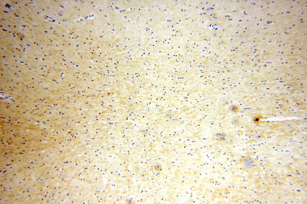 NTF3 IHC Immunohistochemical 18084-1-AP NTF3 Antibody HDNF; MGC129711; NGF-2; NGF2; NT3