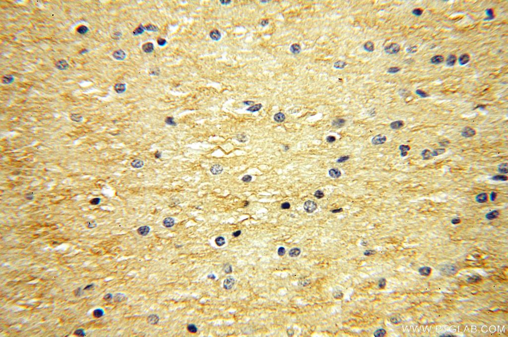 NTF3 IHC Immunohistochemical 18084-1-AP NTF3 Antibody HDNF; MGC129711; NGF-2; NGF2; NT3