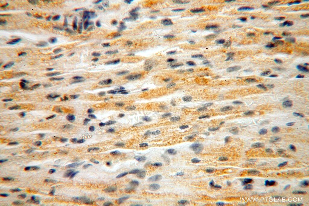 NUDT8 IHC Immunohistochemical 16098-1-AP NUDT8 Antibody FLJ41567
