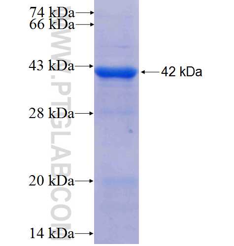 NUP155 fusion protein ag3638 SDS-PAGE