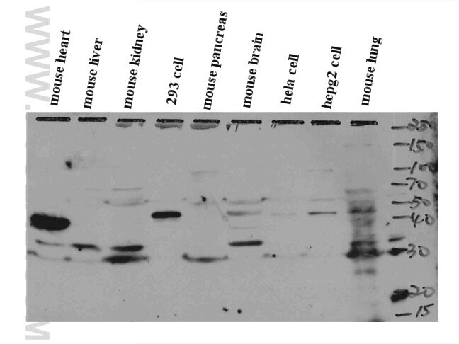 mouse liver tissue were subjected to SDS PAGE followed by western blot with 15986-1-AP(NUS1 Antibody) at dilution of 1:800 NUS1 western blot WB 15986-1-AP NUS1 Antibody C6orf68; MGC117249; MGC7199; MGC:7199; NgBR