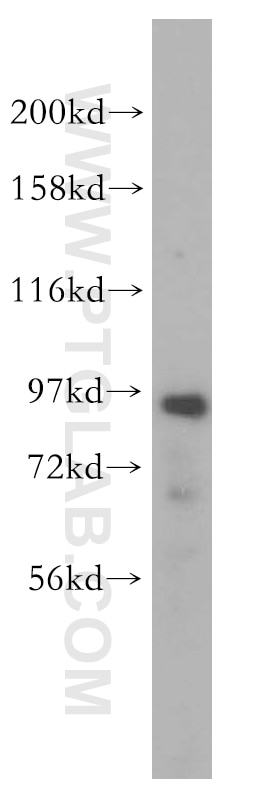 mouse lung tissue were subjected to SDS PAGE followed by western blot with 16970-1-AP(NVL Antibody) at dilution of 1:1500 NVL western blot WB 16970-1-AP NVL Antibody