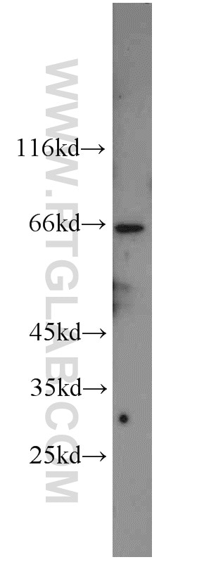 NXF1 western blot WB 10328-1-AP NXF1 Antibody DKFZp667O0311; MEX67; TAP