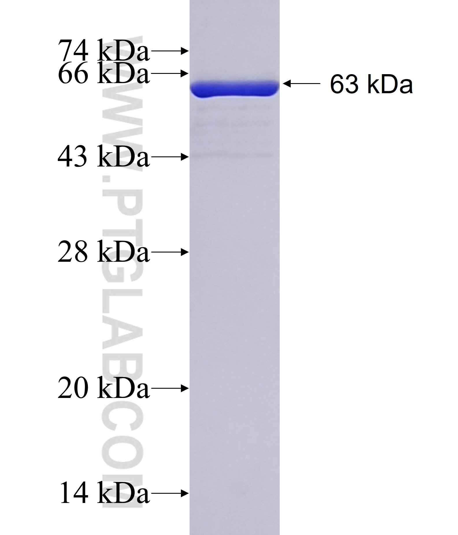 NXN fusion protein ag9113 SDS-PAGE