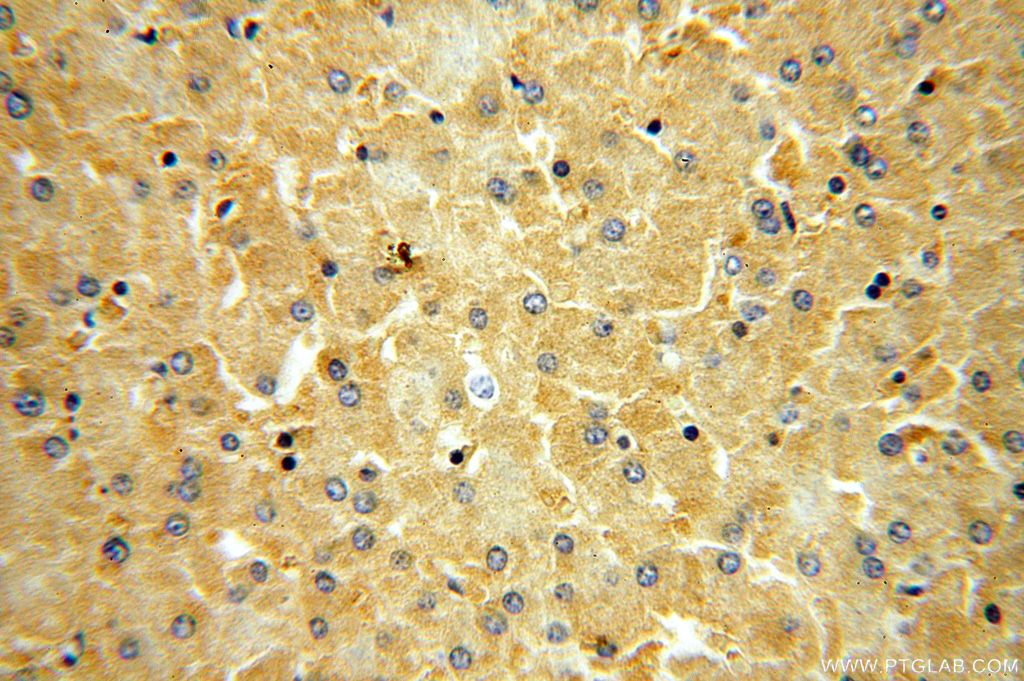 OAS1 IHC Immunohistochemical 14955-1-AP OAS1 Antibody IFI-4; OIAS; OIASI