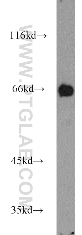 Jurkat cells were subjected to SDS PAGE followed by western blot with 14214-1-AP(OAS2 Antibody) at dilution of 1:500 OAS2 western blot WB 14214-1-AP OAS2 Antibody MGC78578