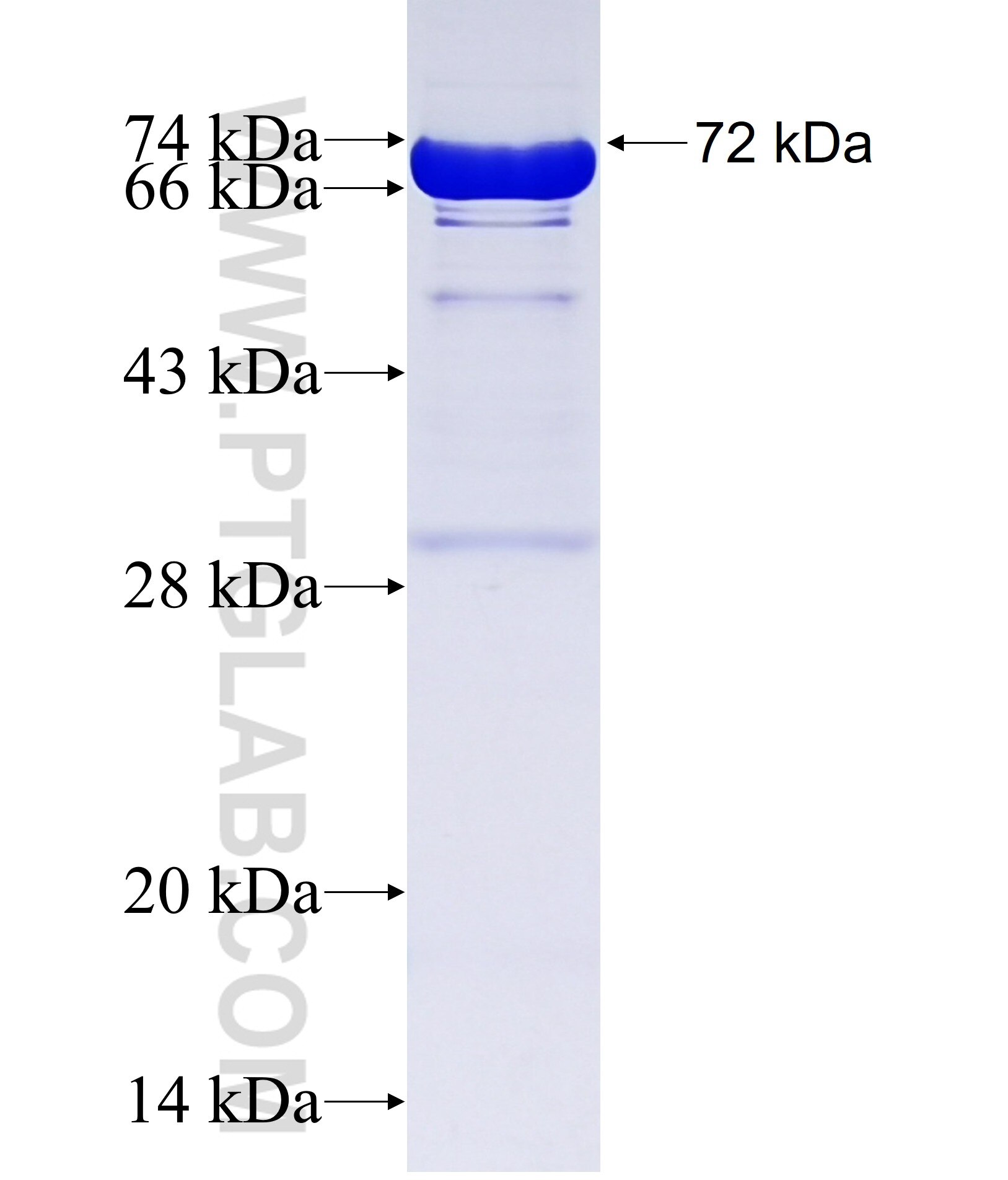 OAT fusion protein ag9981 SDS-PAGE